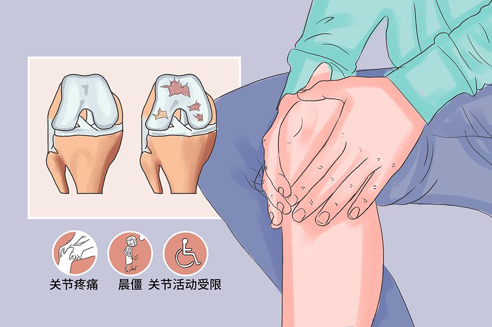 關節炎？3個動作(zuò)保護膝關節